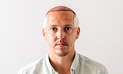 DHI Transplant 07 1 1